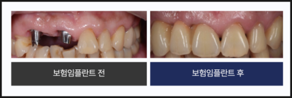 흥미로운 이미지