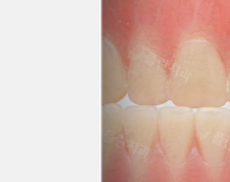 Mysterious appearance