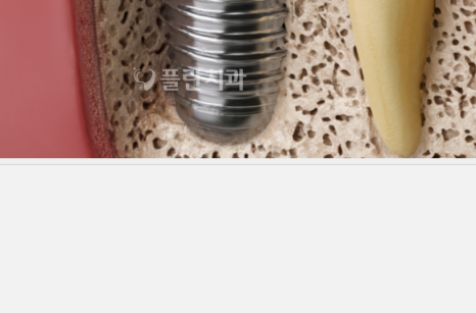 Mysterious appearance